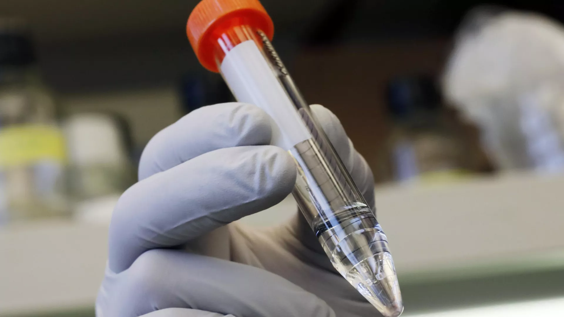 Leia mais sobre o artigo Sputnik Brasil: “Esquecida no Ocidente, pesquisa soviética pode ser saída para problema de resistência antibiótica”